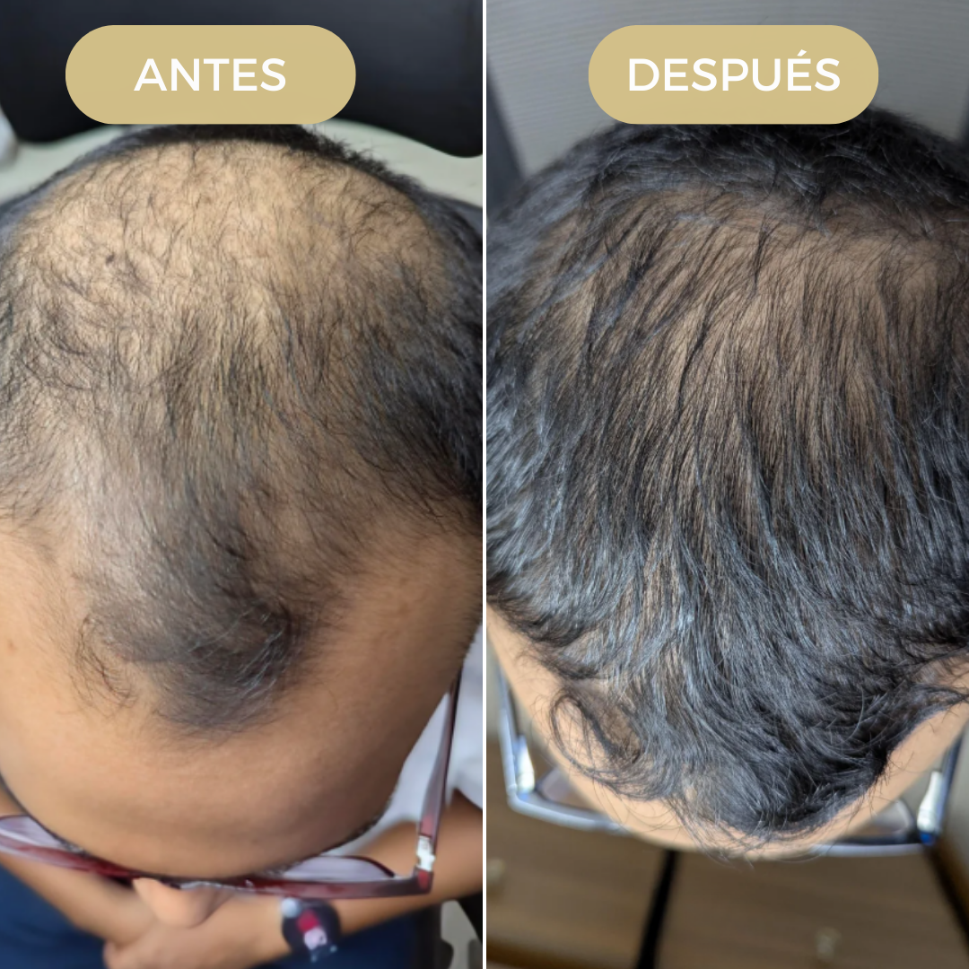 Kit Reactivador Capilar